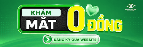 Banner khám mắt miễn phí