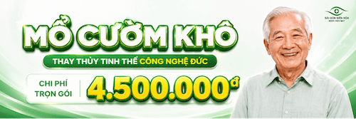 banner mổ cườm