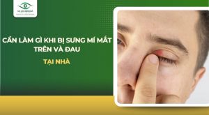 bị sưng mí mắt trên