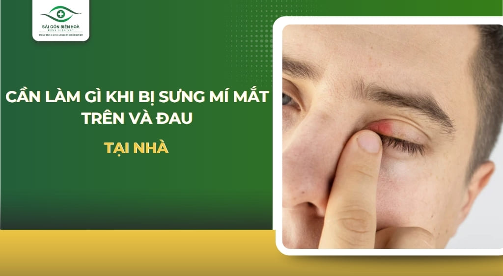 bị sưng mí mắt trên
