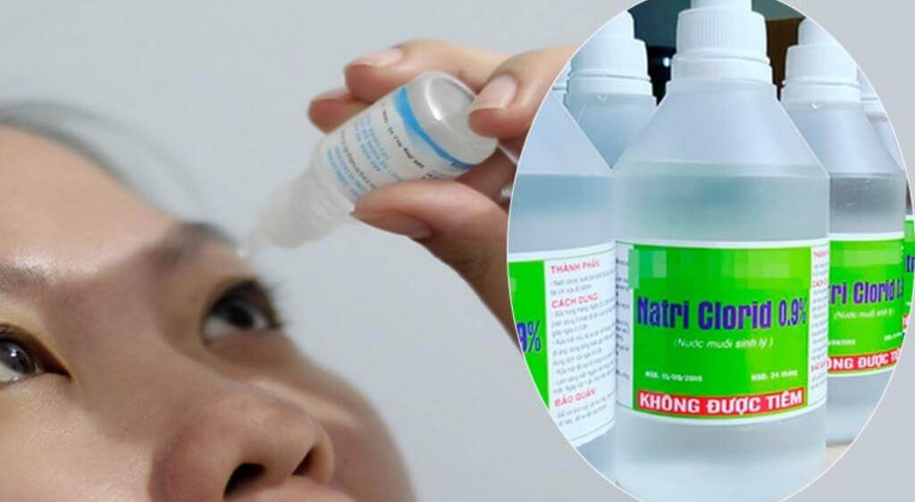 Cách chữa mí mắt bị sưng an toàn là vệ sinh mí mắt bằng nước muối sinh lý 0.9% để làm sạch bụi bẩn