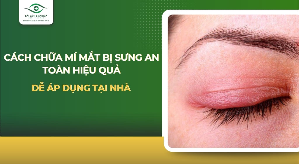 cách chữa mí mắt bị sưng