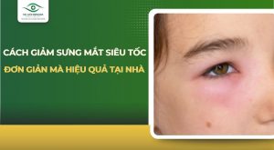 cách giảm sưng mắt
