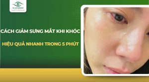 cách giảm sưng mắt khi khóc