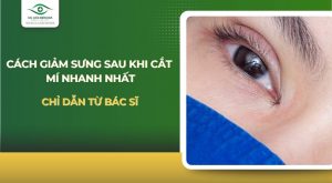 cách giảm sưng sau khi cắt mí