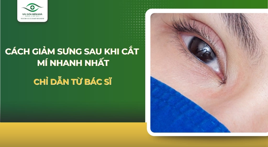 cách giảm sưng sau khi cắt mí