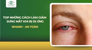Cách làm giảm sưng mắt khi bị dị ứng