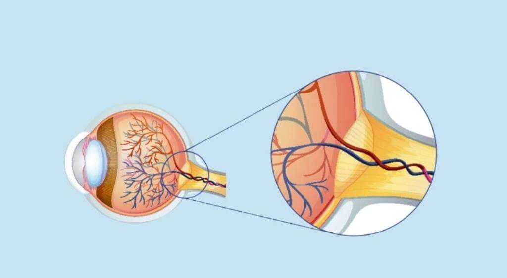 Dây thần kinh thị giác giúp não tiếp nhận và xử lý hình ảnh