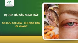 Dị ứng hải sản sưng mắt