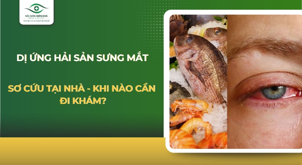 Dị ứng hải sản sưng mắt