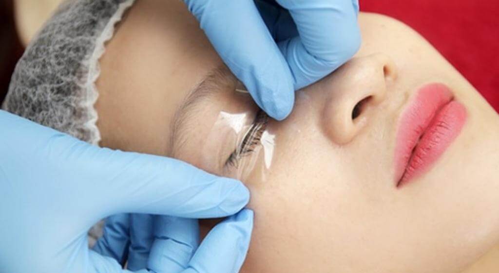 Dùng quá nhiều thuốc tê hoặc dị ứng thuốc tê có thể gây sưng nề và kích ứng vùng mí mắt
