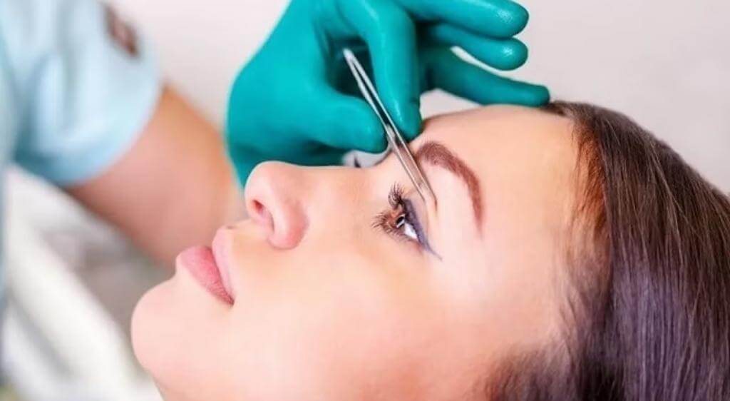 Kỹ thuật phẫu thuật không đảm bảo là nguyên nhân khiến mí mắt sưng lâu