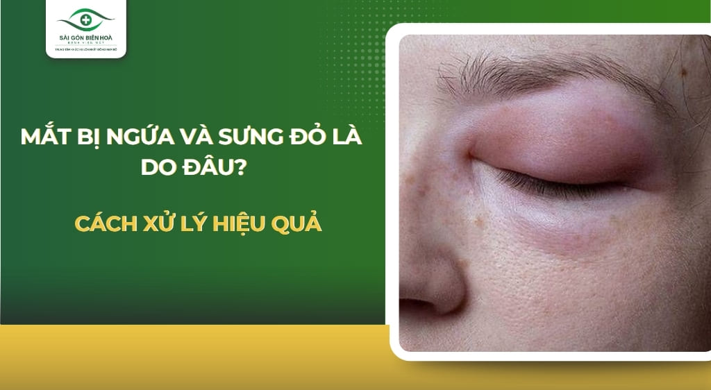 Mắt bị ngứa và sưng