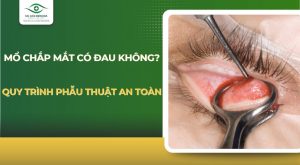 Mổ chắp mắt