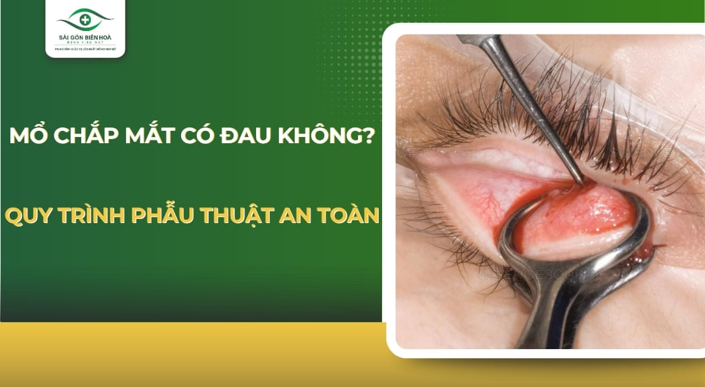 Mổ chắp mắt