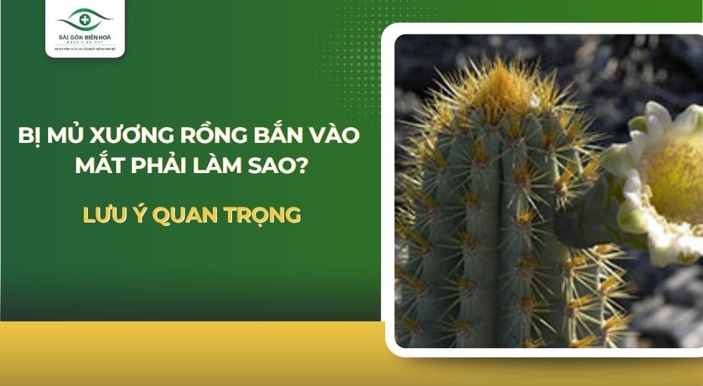 mủ xương rồng bắn vào mắt​