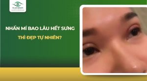nhấn mí bao lâu hết sưng