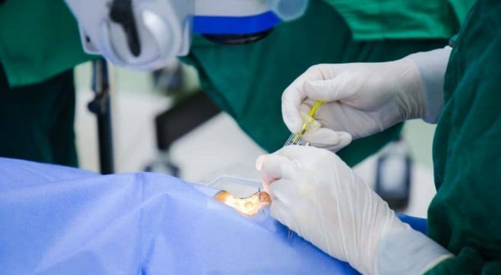 Phẫu thuật ghép kết mạc tự thân giúp giảm nguy cơ tái phát sau phẫu thuật