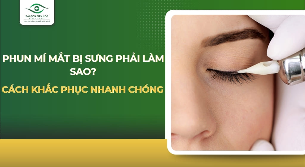 Phun mí mắt bị sưng