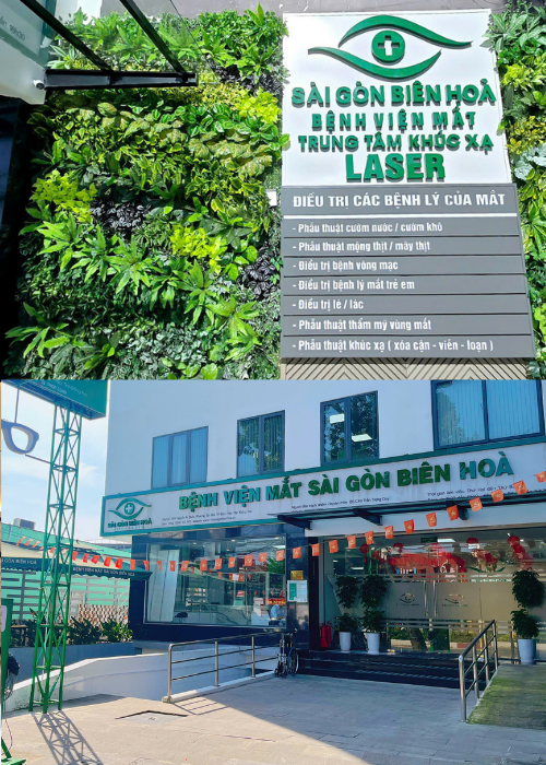 Tại sao nên chọn Bệnh viện Mắt Sài Gòn Biên Hòa