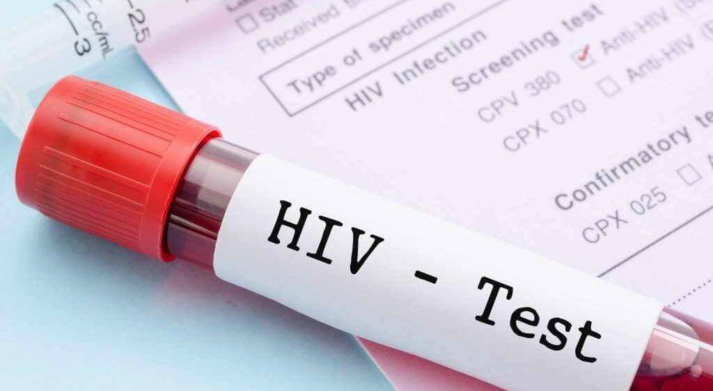 Tình trạng suy giảm hệ miễn dịch như mắc HIV, dùng thuốc chống thải ghép sẽ làm tăng nguy cơ phát triển khối u