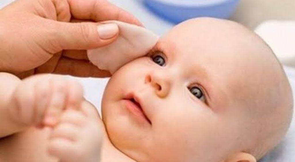 Vệ sinh mắt cho bé bằng nước muối sinh lý 0,9% để loại bỏ ghèn và bụi bẩn trên mắt bé