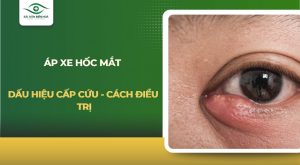 Áp xe hốc mắt