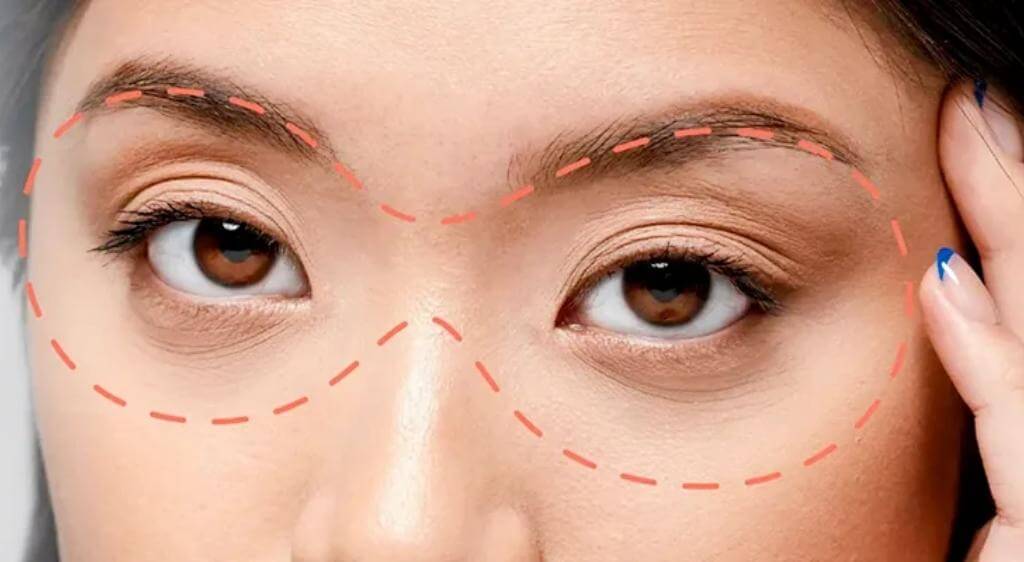 Báo giá nên thể hiện rõ phí khám, lấy và xử lý mỡ, thuốc cùng lịch tái khám.