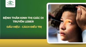 Bệnh thần kinh thị giác di truyền leber