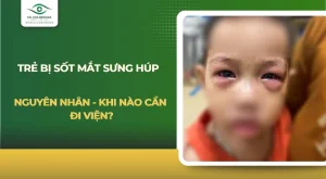 bị sốt mắt sưng húp