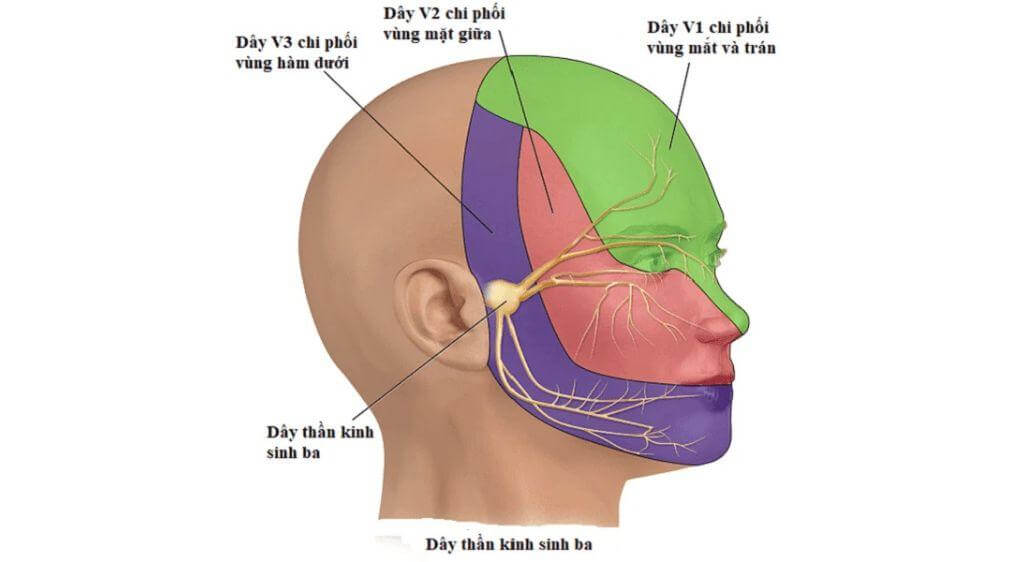Đau dây thần kinh sinh ba có thể gây những cơn đau ngắn, dữ dội giống điện giật ở vùng mặt