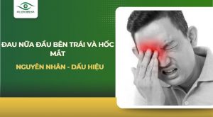 Đau nửa đầu bên trái và hốc mắt
