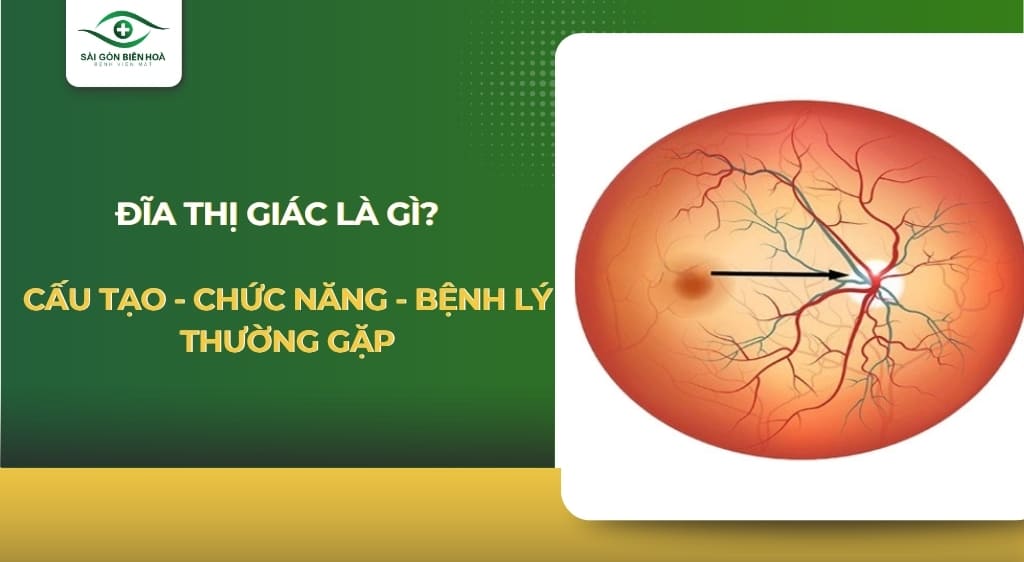 Đĩa thị giác