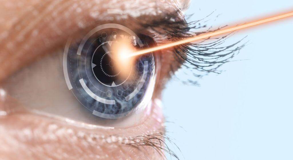 Excimer Laser được coi là trái tim của ngành phẫu thuật khúc xạ hiện đại