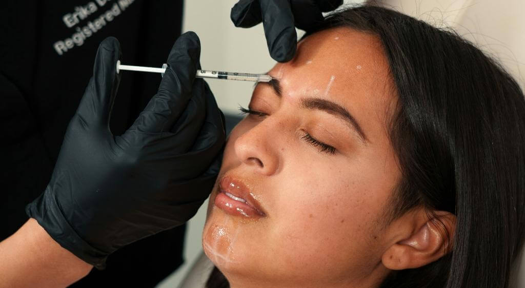 Filler giúp làm đầy vùng mắt hõm và tạo đường nét quanh mắt hài hòa hơn.