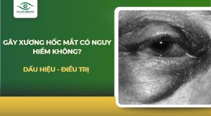 Gãy xương hốc mắt