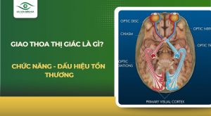 Giao thoa thị giác