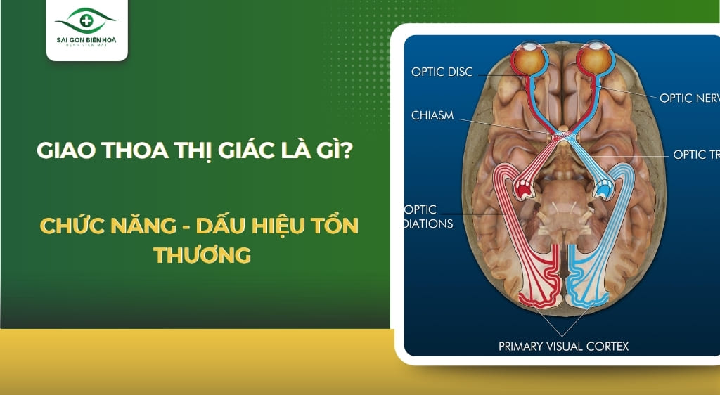 Giao thoa thị giác