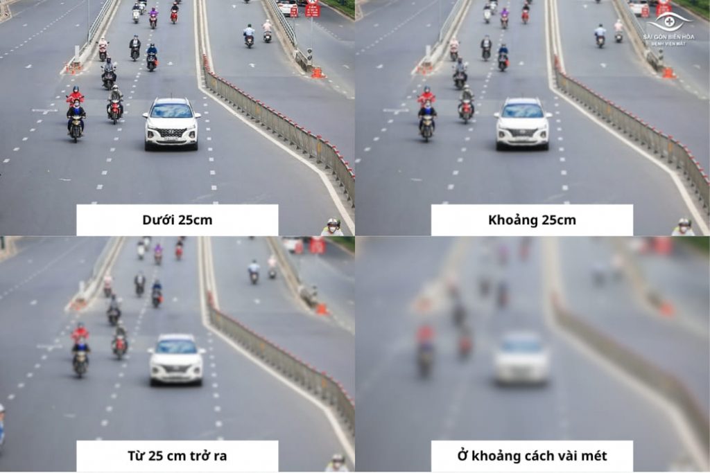 Góc nhìn của người cận 4 độ