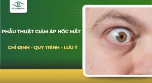 Phẫu thuật giảm áp hốc mắt