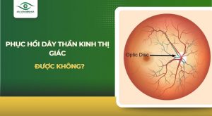Phục hồi dây thần kinh thị giác