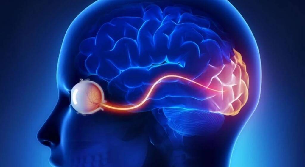 Rối loạn xử lý tín hiệu tại vỏ não thị giác là giả thuyết phổ biến về nguyên nhân gây hội chứng tuyết thị giác