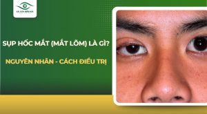 Sụp hốc mắt