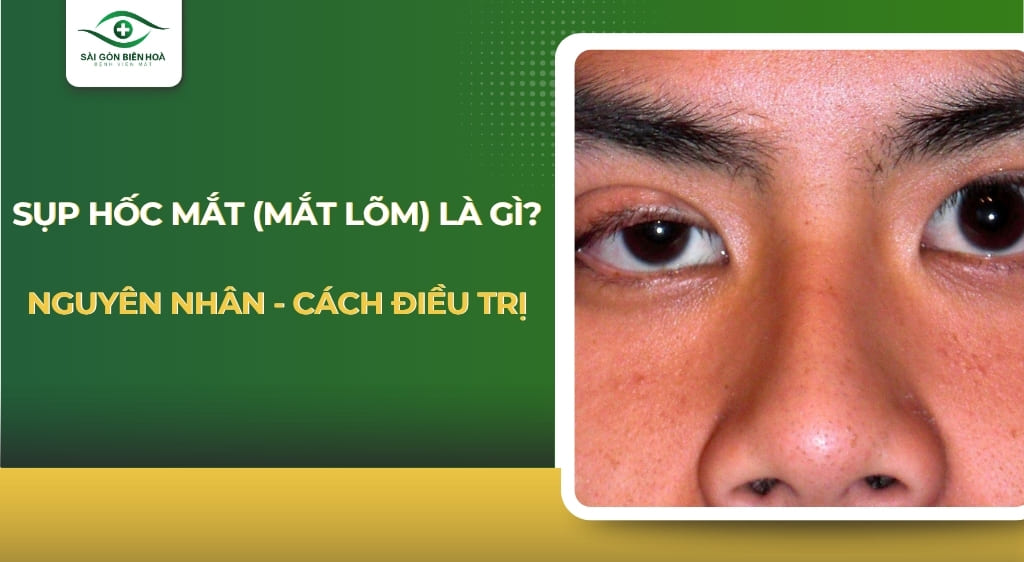 Sụp hốc mắt