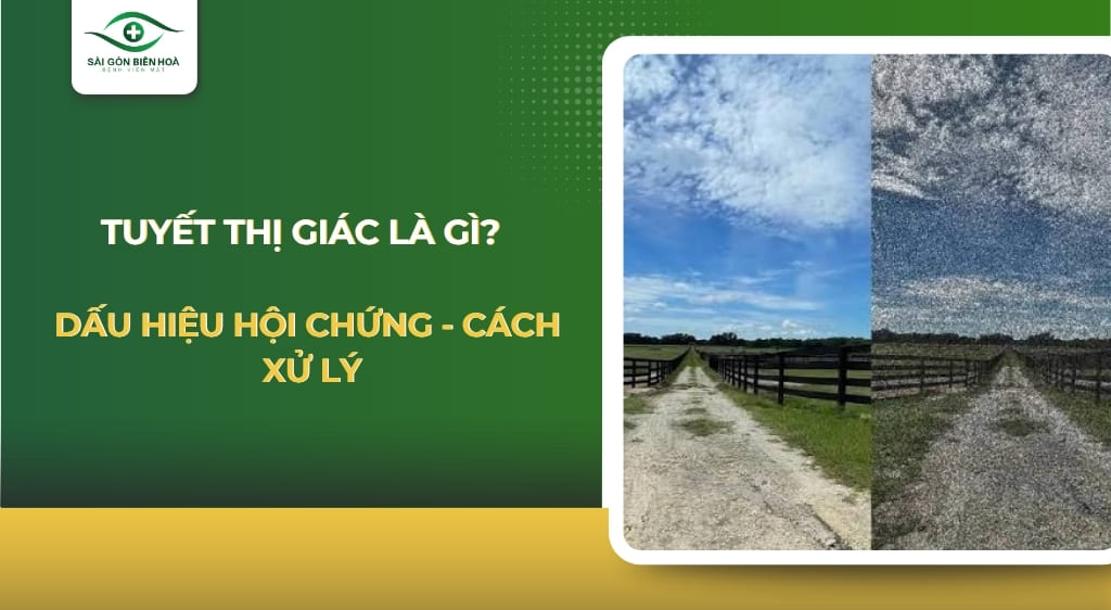 Tuyết thị giác