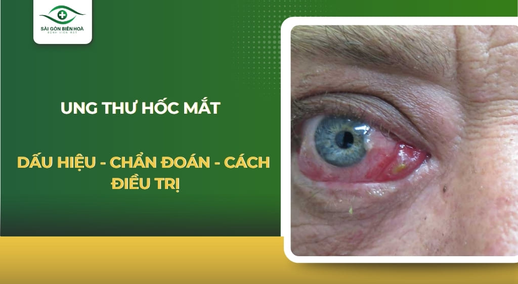Ung thư hốc mắt