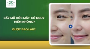 cấy mỡ hốc mắt