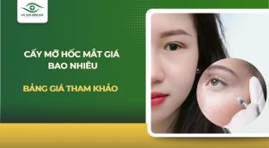 Cấy mỡ hốc mắt giá bao nhiêu