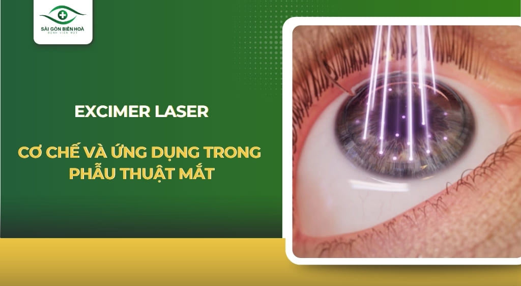 Excimer laser