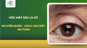 Hốc mắt sâu